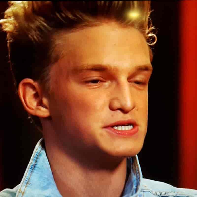 Australian singer Cody Simpson's massive underbite