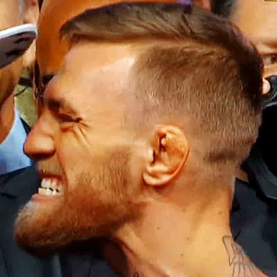 UFC MMA and Boxing star Conor McGregor has an underbite and a strong chin