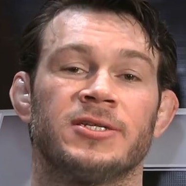 UFC MMA fighter Forrest Griffin has an underbite
