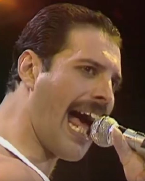 Freddie Mercury's overbite