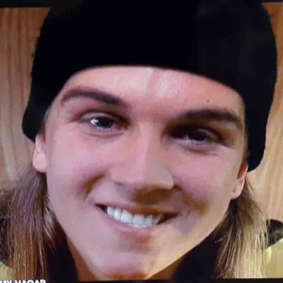 Jay and Silent Bob comedic actor Jason Mewes has an underbite
